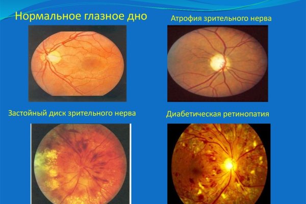 Кракен маркетплейс
