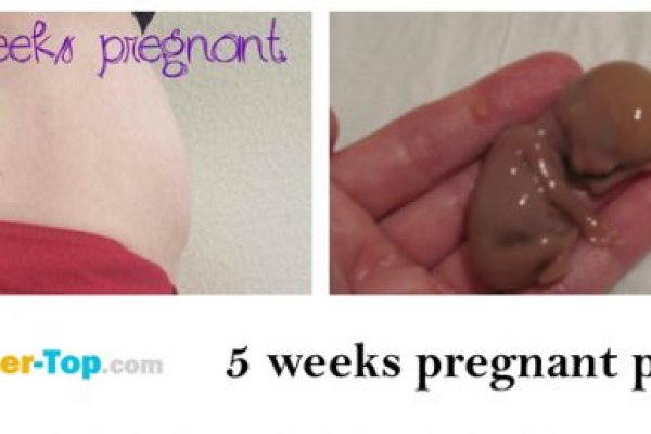 Кракен маркетплейс в москве